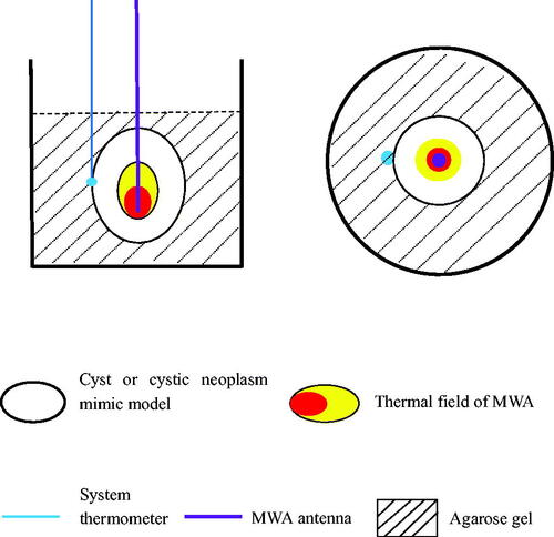 Figure 2. Schematic of MWA and temperature monitoring of cyst and cystic neoplasm mimic models.