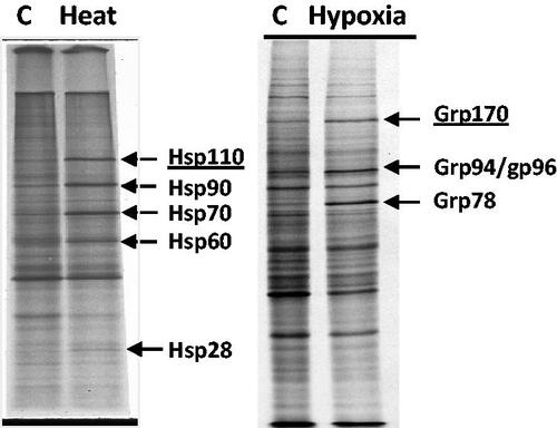 Figure 1. Induction of HSPs by heat shock and GRPs by chronic hypoxia in CHO cells. Protein synthesis was examined using 35S-methionine pulse assays, followed by SDS-polyacrylamide gel electrophoresis and autoradiograph analysis. Left panel reproduced from Subjeck et al., Br J Cancer, 1982 [17]; right panel unpublished.