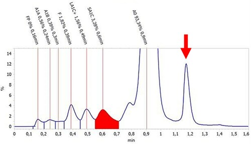 Figure 2. Chromatogram of the patient’s sample analyzed with a Tosoh HLC-723 G8 analyser using the standard HbA1c mode. HbA1c, in red, measured at 3.3% in this mode (12.3 mmol/mol) at 0.6 min. An additional unidentifiable peak is shown at approximately 1.15 min (arrow), indicating the presence of abnormal unstable Hb M Saskatoon.