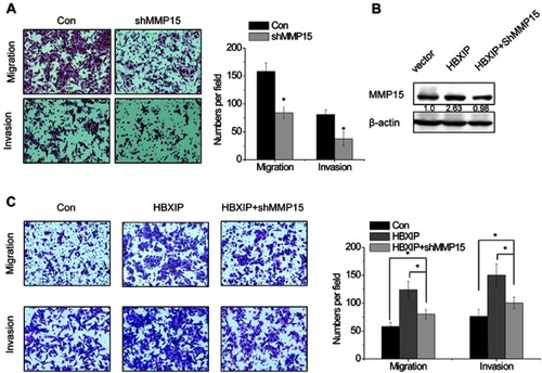 Figure 4 MMP15 is involved in HBXIP-induced HCC cell migration and invasion. (A) The effect of MMP15 knockdown on cell migration and invasion was determined by Transwell assay. (B) The MMP15 shRNA was transfected into HBXIP overexpressing SMMC-7721 cells. After 48 hrs, the MMP15 protein expression was detected by western blot. (C) The cell migration and invasion were examined in the HBXIP overexpressing SMMC-7721 cells transfected with MMP15 shRNA (ANOVA and LSD test). *P<0.05.Abbreviations: HCC, hepatocellular carcinoma; HBXIP, hepatitis B virus X-interacting protein.