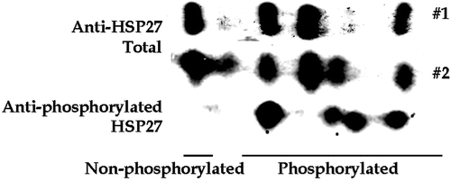 Figure 3. Specificity of an antibody specific for phosphorylated HSP27. The HSP27 isoforms from HeLa cells that had been heated at 45°C for 30 min were resolved by 2D-polyacrlamide gel electrophoresis. The resolved proteins on three separate gels were probed with an antibody for total HSP27 and an antibody for phosphorylated HSP27, as indicated on the figure.