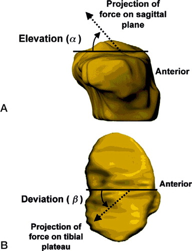 Figure 2 Definition of orientation angles of the force. A. The elevation angle is measured in the sagittal plane. B. The deviation angle is measured in the plane of the tibial plateau