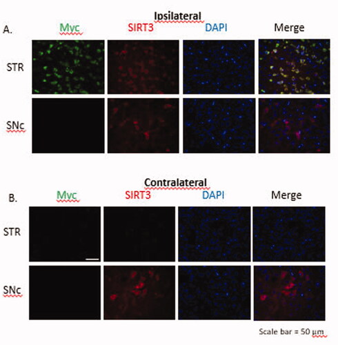 Figure 8. Immunofluorescent images to show transduction of SIRT3-myc following MRg-FUS induced BBBB permeabilization. Fourteen days following MR-g-FUS mediated BBB permeabilization and administration of AAV.SIRT3-myc, animals were euthanized and brains removed, then processed for immunofluorescent analysis. In the hemisphere ipsilateral to FUS application, SIRT3-myc was successfully expressed in the striatum, but not the SNc. No SIRT3-myc expression was observed in the contralateral hemisphere. Antibodies: Myc (SIRT3-myc), SIRT3 (endogenous and ectopic SIRT3), and DAPI (nucleus). n = 5.