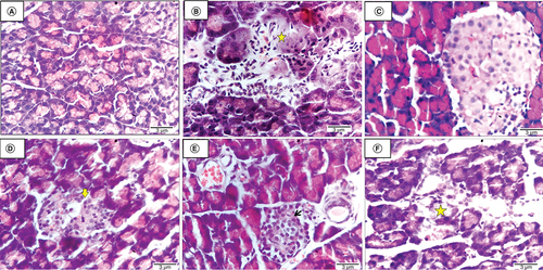 Figure 7. Histological investigations of pancreatic tissue of different groups.(A) Negative control rat displaying normal pancreatic architecture with active pancreatic acini. (B) Untreated diabetic rat revealing shrinkage of Langerhans islets and pancreatic acini associated with necrosis of components cells (star). (C) Diabetic rat infused with ADSCs + Se/Ti (III)-derived insulin-producing cells (IPCs) showing normal Langerhans islets and active pancreatic acini. (D) Diabetic rat implanted with adipose-derived stem cells +CeO2-derived IPCs showing shrinkage of Langerhans islets and pancreatic acini, with degeneration pyknosis and karyolysis is evident (arrow). (E) Diabetic rat infused with BMSCs + Se/Ti (III)-derived IPCs showing normal Langerhans islets (arrow) with some dilatation of blood capillaries and pancreatic ducts. (F) Diabetic rat injected with BMSCs + CeO2-derived IPCs showing shrinkage and necrosis of Langerhans islets (star) (H&E, ×400, scale bar: 3 μm).