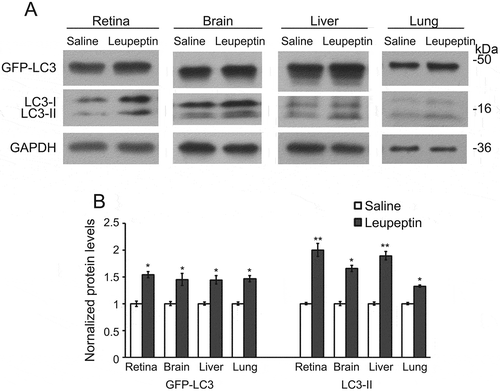 Figure 5. Intraperitoneal injection of leupeptin as a method to inhibit autophagy flux. (a) Immunoblot and (b) quantification of the levels of GFP-LC3, LC3-I, LC3-II, and GAPDH in the retina, brain, liver and lung of GFP-LC3 mice with a single intraperitoneal injection of leupeptin versus saline (as control). Samples are from the cell lysates and demonstrate the increase in LC3-II relative to LC3-I in the leupeptin sample. Protein levels are normalized to GAPDH levels. * P < 0.05; ** P < 0.01. For the immunoblots, 8 µg of protein was loaded per lane. Antibodies: LC3 (1:1000; Cell Signaling Technology, 4108); GAPDH (1:60,000; Ambion Applied Biosystems, AM4300).