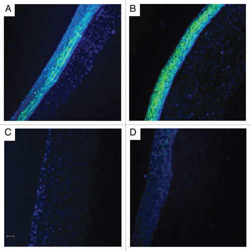 Figure 3 TEVM cell phenotype modulation. Comparison of untreated control (A), with TEVMs treated with TGFβ1 (B) demonstrated a significant increase in smooth muscle α-actin while the addition of TNFα alone (C) or in combination with TGFβ1 (D) resulted in a significant decrease in α-actin staining. Smooth muscle a-actin (green) and Hoechst nuclei dye (blue) are shown. The scale bar represents 50 µm and is applicable to all panels.