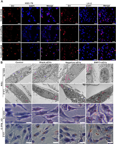 Figure 7 Effect of BMP7+sEVs on aHSCs. (A) Co-localization of Dil-labeled blank-sEVs, negative-sEVs, and BMP7+sEVs (red), and cell nuclei stained with DAPI (blue) after sEVs treatment of aHSCs for 12 h. Scale bars: 50 µm. (B) Visualization of LDs using TEM and Oil Red O staining in control (negative control), blank-sEVs, negative-sEVs, and BMP7+sEVs after sEV treatment of aHSCs for 48 h. The three types of colored arrows in the TEM indicate the different types of LDs (blue: cholesterol LDs, red: triglycerides LDs, pink: mixed LDs). TEM scale bars: 5.0 µm, Oil Red O staining scale bars: 6 µm.