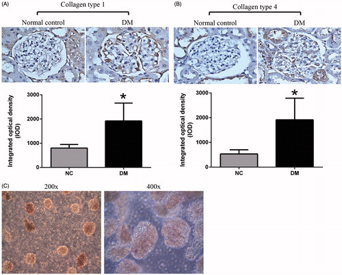 Figure 2. (A) Immunohistochemical photograph of glomeruli in rats with and without diabetes. The diabetic group expressed stronger type I collagen (A) and type IV collagen (B) expression when compared with the normal group. Semi-quantitative evaluation of the positive immune-labeled cells was shown below for type I and IV collagen staining. Data were expressed as mean ± SE. *p < 0.05 versus control group. Specimens were observed under magnification 400×. (C) Histological examination of rat glomeruli subjected to magnetic bead perfusion. An adult rat was perfused with magnetic beads through the heart and glomeruli were isolated.