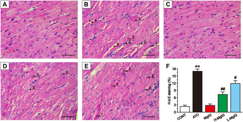 Figure 2 Effects of MgIG on pathological changes of cardiac tissue as surveyed by H&E staining. Scale bar = 50 µm (H&E, 400 ×). Myocardial tissues are respectively from the CONT group (A), ATO group (B), MgIG alone treatment group (C), H-MgIG group (D), and L-MgIG group (E). The arrows on the myocardial tissue images represent The area of myocardial injury in each group was calculated (F). The arrows on the images of myocardial tissue represent apoptosis (1), inflammatory cell infiltration (2), myocardial necrosis (3), capillary dilatation and congestion (4), and intermyocardial edema (5), respectively. The values were presented as the mean ± SEM. ** P < 0.01 vs CONT; #P < 0.05, ##P < 0.01 vs the ATO group, n = 6.