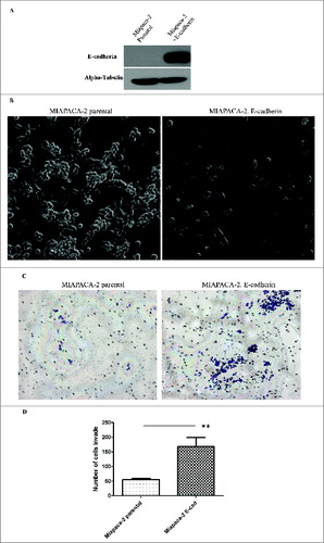 Figure 2. Ectopic expression of E-cadherin increases the Epithelial look of the cell but does not prevent in vitro invasion of tumor cells. (A) Western blot showing the expression level of E-cadherin in Miapaca-2 parental cells VS Miapaca-2 with E-cadherin overexpression. (B) Phase contrast photographs of control MIAPACA-2 cells and E-cadherin overexpressing MIAPACA-2 cells. (C) In vitro invasion assay of Miapaca-2 cells with/without E-cadherin. Experiment results are from 3 triplicates of 3 independent experiments. ** indicates the statistical analysis of the result shows significant difference. P < 0.01.