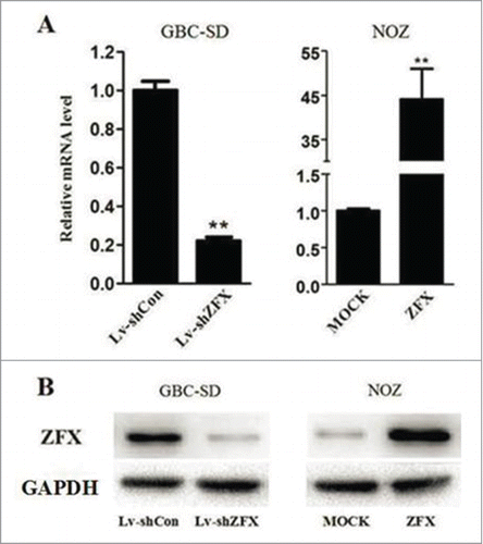 Figure 3. Efficiency and specificity of ZFX knockdown/over-express in GBC cell lines. (A) Relative ZFX mRNA expression was determined using real-time PCR. GAPDH was used as an internal control. (B) Total cellular proteins detected by western blot analysis in ZFX-knockdown GBC-SD cells and SPOCK1 over-expressing NOZ cells, GAPDH was used as an internal control. The data represent the mean±SD of 3 independent experiments. Significant differences from the control are indicated by **p < 0.01.