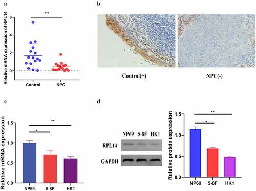 Figure 1. RPL14(eL14) is down-expression in NPC. The relative mRNA expression of RPL14(eL14) in NPC and chronic nasopharyngitis tissues (a). The immumohistochemical staining of RPL14(eL14) in NPC and chronic nasopharyngitis tissues (b). RPL14(eL14) is down-expression in normal nasopharyngeal epithelial cell line (NP69) when compared with NPC cell lines (5–8 F and HK1) based on qRT-RCR and western blot (c,d). *p < 0.05, **p < 0.01 and ***p < 0.001