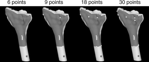 Figure 7. Registration points from Simulation set 3 generated on the distal radius by Qseq starting from a set of six points that poorly constrain the registration problem. The six points are the almost collinear cluster on the shaft of the radius.