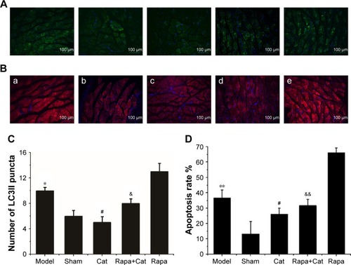 Figure 3 Suppression of autophagy and apoptosis by catalpol during the acute phase of sciatic nerve crush injury.