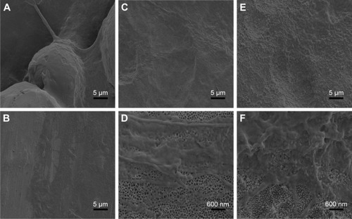 Figure 9 Representative SEM images of HGFs’ adhesion on the surfaces of each group after 24 hours (scale bar of A–C, E =5 µm, scale bar of D, F =600 nm).Notes: (A) SLM; (B) MP; (C, D) AO; (E, F) AOC.Abbreviations: SEM, scanning electron microscopy; HGFs, human gingival fibroblasts; SLM, selective laser melting; MP, mechanically polished; AO, anodic oxidation; AOC, anodic oxidation composited with electrochemical deposition.