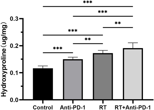 Figure 5 Hydroxyproline content (µg/mg) in lung tissue in the four groups of mice. **P<0.01, ***P<0.001. Abbreviation:RT, radiation therapy.