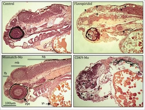 Figure 3. Haematoxylin and eosin histological staining. Zebrafish embryos (Wik, wild type strain) injected with CDK9-targeting morpholino or exposed to Flavopiridol 3uM showed increased appearance of apoptotic/necrotic bodies (black and red arrowheads, respectively), particularly in the brain area, with underdeveloped forebrain and midbrain, compared to control (black arrow). Fb, forebrain; mb, midbrain; hb, hindbrain; Ys, yolk sac.
