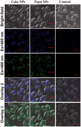 Figure 3. Bright field and fluorescence microscope images of malignant melanoma cells incubated with Coke NPs and Pepsi NPs for 24 h. Exposure time was 400 ms. Control cells were incubated without NPs. Scale bar = 20 µm.