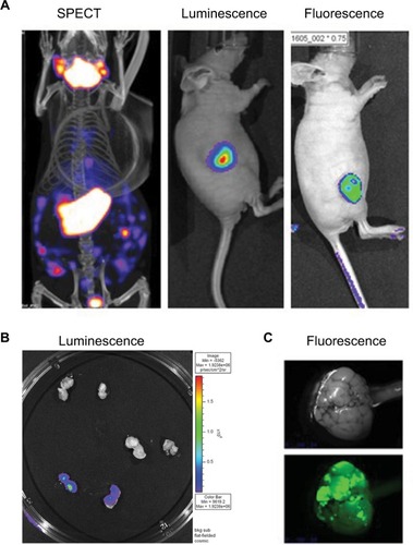 Figure 2 PET CT; bioluminescence and fluorescence illustration for use in cancer field.Notes: (A) HT29 tumors were established subcutaneously in nude mice. Then vaccinia virus was injected intratumorally at 1×107 pfu as follow: vaccinia virus expressing NIS for SPECT image, vaccinia expressing firefly luciferase tag for bioluminescent image or vaccinia expressing eGFP tag for fluorescence. Four days after virus treatment, the mice were injected with 99Tc radioisotope for small-animal SPECT/CT imaging, D-luciferin (Molecular Imaging Products, Ann Arbor, MI, USA) for bioluminescent. Images were taken using the in vivo imaging system IVIS 200 Series Imaging System (Xenogen, Hopkinton, MA, USA). Luminescent and fluorescent images data acquisition and analysis were performed using Living Image v2.5 software. (B) Ht29 tumors were established subcutaneously in nude mice. Fourteen days after tumor seeding, the mice were injected with vaccinia virus expressing firefly luciferase tag (3), vaccinia virus with no imaging reporter (2) or not injected (1). Mice were sacrificed, tumor harvested and cut in half for imaging analysis. (C) Transgenic mice (90 days old) were treated with vaccinia-expressing fluorescent marker intravenously. Four days later, the mice were sacrificed, tumor harvested and processed for image testing. Top: brightness and contrast; Bottom: fluorescence.