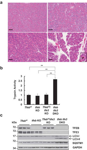 Figure 8. tfe3 and acinar cell-specific tfeb double-knockout (DKO) mice develop spontaneous pancreatitis. BAC-Ela-Cre−; Tfebf/f (Tfebf/f), BAC-Ela-Cre+; Tfebf/f (tfeb KO), BAC-Ela-Cre−; Tfebf/f tfe3 KO (Tfebf/f tfe3 KO) and BAC-Ela-Cre+; Tfebf/f tfe3 KO (tfeb tfe3 DKO) mice were injected with tamoxifen (75 mg/kg) once a day for consecutive 5 days and these mice were sacrificed 5 days later after the last injection of tamoxifen. (a) Representative images of H & E staining of Tfebf/f, tfeb KO, Tfebf/f tfe3 KO and tfeb tfe3 DKO mice are shown. Bar: 50 μm. (b) Pancreatic trypsin activity was measured. Data shown are mean ± SE (n = 3–4). **p < 0.01; One-way ANOVA analysis. (c) Total pancreatic lysates were subjected to Immunoblotting analysis.