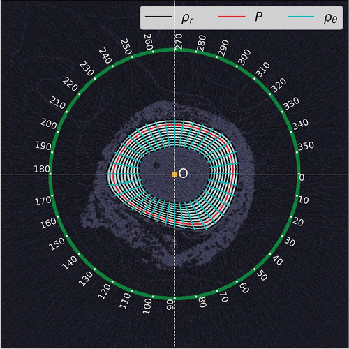 Figure 3. Examples of paths over which circumferential line average (ρˉr), maximum circumferential line average (P), and radial line average (ρˉθ) BMD were calculated.