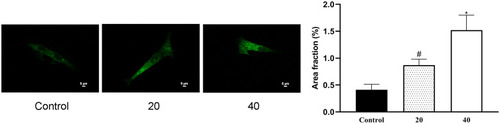 Figure 6 The impact of ICAII on DU145 cell autophagy. DU145 cells were transfected using the GFP-LC3 plasmid. The autophagic area as a fraction of the total area in these DU145 cells was quantified. #P <0.05, vs control; *P <0.01, vs control.
