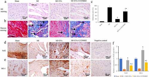 Figure 6. The inhibitor of Akt/Nrf2/HO-1 pathway remarkably reversed the effect of EVs on morphological changes of MI rat heart tissues. (a) The influence of EVs and LY294002 on morphological changes was measured via HE staining; (b) The influence of EVs and LY294002 on collagen deposition was measured via Masson staining; (c) The influence of EVs and LY294002 on infarction ratio was analyzed; (d) The influence of EVs and LY294002 on Nrf2 expression was detected via IHC; (e) The influence of EVs and LY294002 on HO-1 expression was detected via IHC; (f) The levels of Nrf2 and HO-1 were analyzed. * P < 0.05 compared with the group MI. # P < 0.05 compared with the group MI+EVs. Black arrows indicated the collagen fiber deposition measure with Masson staining.