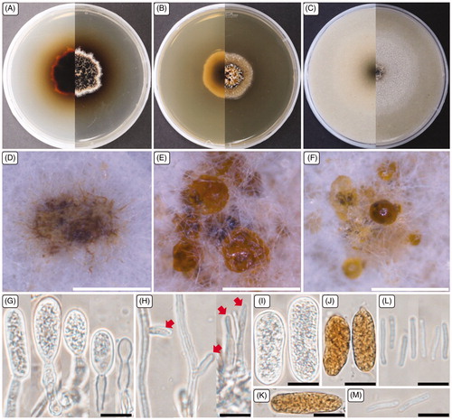 Figure 3. Cultural and morphological characteristics of 17E-039. (A) Colonies were grown on potato dextrose agar; (B) Malt extract agar; (C) Oatmeal agar at 25 °C for 14 days, reverse and obverse side view, respectively. (D–F) Conidiomata forming on oatmeal agar; (G) Macroconidiogenous cells; (H) Microconidiogenous cells; (I–K) Macroconidia; (L, M) Microconidia. Arrows indicate microconidiogenous cells. Scale bars: D–F = 500 μm; G–M = 10 μm.