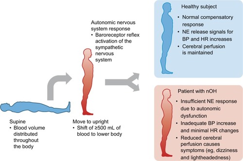 Figure 2 Hemodynamics of postural change in healthy subjects and patients with nOH.