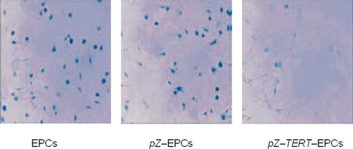 Figure 5. SA–β-galactosidase (β-gal) activity for cell senescence. After cultured for 2 weeks, the proportion of positive cells producing SA–β-galactosidase in the pZ-TERT-E PCs group was significantly lower than that of the pZ-EPCs and EPCs groups.