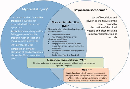 Figure 1. Conceptualisation of the definitions of myocardial infarction and myocardial injury.Footnote: aType 1 MI: Caused by coronary artery disease and precipitated by plaque disruption (rupture or erosion); bType 2 MI: Ischaemic myocardial injury caused by a mismatch between oxygen supply and demand.