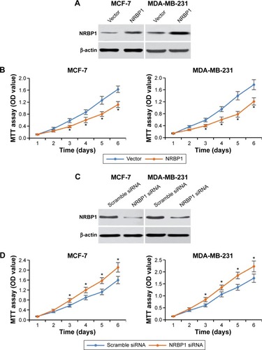 Figure 3 NRBP1 regulates breast cancer cell proliferation.