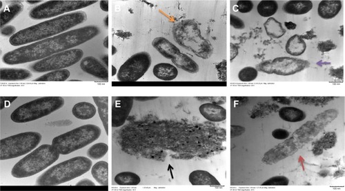 Figure 3 TEM of mucoid and nonmucoid strains of Pseudomonas aeruginosa.Notes: Exponential phase bacteria were treated with 4× MIC of AgCNTs for 4 hours at 37°C, and centrifuged at 2000× g for 10 minutes. The pellets were then washed in 0.1% PBS and fixed overnight in a mix of 2.5% glutaraldehyde and 1% formaldehyde in 0.1% PBS. Samples were treated with 1% osmium tetroxide in 0.1% PBS, before stepwise dehydration in increasing concentrations of ethanol in water. After dehydration, the samples were passed through propylene oxide and infiltrated with Embed 812 resin and polymerized overnight. Ultrathin sections were collected on copper grids stained with 2% uranyl acetate and lead citrate and imaged using the TEM. (A) and (D) show images of untreated mucoid and nonmucoid cells, respectively, with intact cell membranes. (B) and (C) show AgCNT-treated mucoid cells with efflux of cellular material and empty ghost cells (orange and purple arrows), whereas (E) and (F) show cells with intracellular material completely disintegrated (black and red arrow) and the absence of cell membranes.Abbreviations: AgCNTs, silver-coated carbon nanotubes; MIC, minimum inhibitory concentration; SEM, scanning electron microscopy; TEM, transmission electron microscopy.