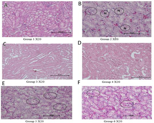 Figure 3 Histological micrographs for the kidney H&E stain.