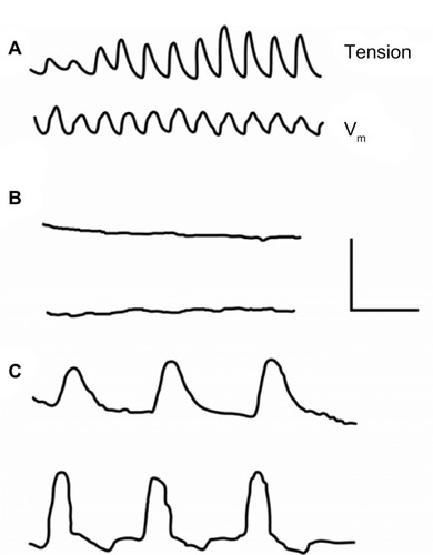 Figure 2 Recording from cat small intestinal muscle segment of mechanical (upper) and electrical (lower) activity in normal solution (A), 7 minutes after change to calcium-free solution (B), and 50 minutes after change to calcium-free solution (C). As shown in (C), prolonged potentials triggered contractions. Electrical recordings were made with pressure electrodes. Calibration bar: A/B, 0.4 mV, 0.8 g, 16 seconds; C, 0.27 mV, 0.13 g, 10 seconds. Reproduced with permission from Mangel AW, Nelson DO, Rabovsky JL, Prosser CL, Connor JA. Depolarization-induced contractile activity of smooth muscle in calcium-free solution. Am J Physiol. 1982;242(1):C36–C40.Citation8