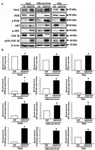 Figure 12. Expression of PI3K/Akt signaling pathway members in MEDTiP-implanted calvarial defect rats. Expression levels of seven proteins in three different tissue types were determined using an imaging densitometer. The level of each protein is presented relative to the intensity of actin. Two to three rats per group were used to prepare tissue homogenates, and western blot analysis was performed in duplicate for each sample. Data are reported as the mean ± SD. *, p < 0.05 relative to the TiP-implanted group. Abbreviations: TiP, Titanium plate, MEDTiP, MED-coated titanium plate.