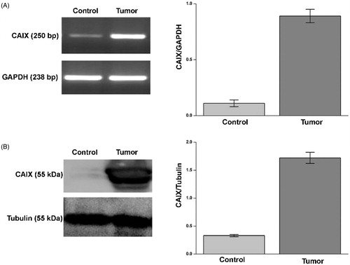 Figure 1. CA IX expression in ccRCC samples. mRNA levels (panel A, left side) evaluated by RT-PCR and protein levels (panel B, left side) evaluated by WB of CA IX in normal tissue (Control) and tumour sample (tumour) of a representative patient. GAPDH housekeeping gene amplification products and tubulin housekeeping protein were used to normalise values from RT-PCR and western blot, respectively; in right side of panel A (RT-PCR) and B (WB) are reported the densitometric values of samples from eight patients. Differences were significant for p ≤ .005 with t-test.