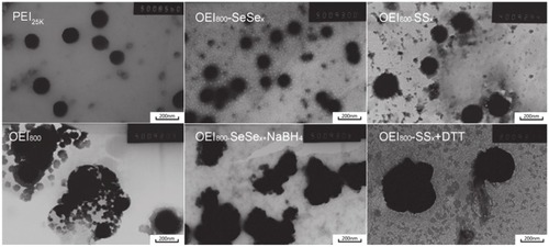 Figure 3 Transmission electron microscopy results for PEI25k, OEI800, and OEI800-derived complexes dropped onto amorphous carbon-coated copper grids, dried, and dyed using phosphomolybdic acid.Note: Bar = 200 nm.Abbreviations: DTT, 1,4-dithiothreitol; OEI, oligoethylenimine; PEI, polyethylenimine.