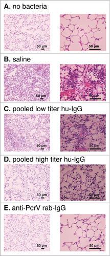 Figure 8. Lung histology 24 h after bacterial instillation. Saline, pooled low titer hu-IgG, pooled high titer hu-IgG, or anti-PcrV rab-IgG was intravenously administered 1 h prior to tracheal instillation of a lethal dose (1.5 × 106 CFU/mouse) of P. aeruginosa PA103. A. no bacterial control (tracheal instillation of saline solution alone). B. intravenously pretreated with saline. C. intravenously pretreated with pooled low titer hu-IgG. D. intravenously pretreated with pooled high titer hu-IgG. E. intravenously pretreated with anti-PcrV rab-IgG. Mouse lungs were fixed 24 h after bacterial instillation. Hematoxylin-eosin staining was conducted after 10% formaldehyde fixation and paraffin embedding. Magnification, 100× and 400×.