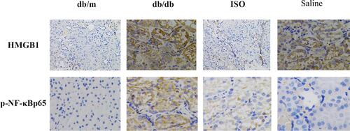 Figure 6 Effects of ISO on inflammatory factors in the kidney. Immunohistochemical staining of HMGB1 and p-NF-κB in the kidney tissues. Magnification: 20x.