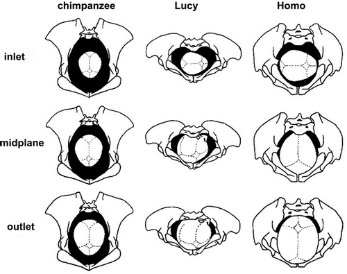 Figure 29. Rotational birth in Homo (from Tague Citation1986, with permission).