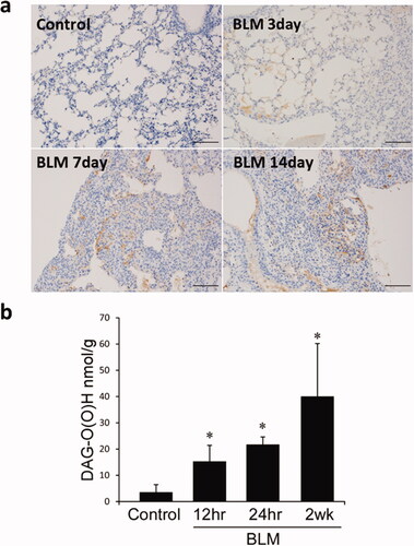 Figure 2. Accumulation of lipid peroxides in the lungs induced by the administration of BLM. (a) Immunohistochemistry was performed using paraffin-embedded mouse lung sections on days 3, 7 and 14 after the administration of BLM; staining for 4-HNE was performed. There was no staining for 4-HNE observed in the control group. Accumulation of 4-HNE was observed on days 3, 7 and 14 after the administration of BLM; 4-HNE staining was observed in lung epithelial cells. (b) Lipids in tissues were extracted from fresh frozen lung tissues using isopropyl alcohol and methanol; oxidized DAG was purified and quantitatively analyzed using HPLC. The administration of BLM resulted in a marked accumulation of oxidized DAG. P < 0.05 denotes a statistically significant difference. 4-HNE: 4-hydroxyl-2-nonenal; BLM: bleomycin; DAG: diacylglycerol; HPLC: high-performance liquid chromatography.