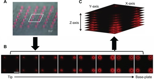 Figure 4 CLSM images of NR-NLC distribution in the MNs revealing even distribution of the nanocarrier throughout the needle.Notes: (A) Microscopic image of NLC-MN array. (B) Confocal images of the xy-plane in z-series (sequential xy sections, interval =56 μm). (C) z-series rotated (x: 72.5°, y: 316.7°, z: 287.7°) and stacked perpendicularly. The white scale bar represents 500 μm.Abbreviations: CLSM, confocal laser scanning microscopy; NLC-MN, nanostructured-lipid-carrier-loaded microneedle; NR, nile red; MNs, microneedles.