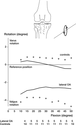 Figure 13. Tibial rotations around the sagittal axis (varus/ valgus rotation) are illustrated. In the group with lateral osteoarthritis the tibia rotated into valgus as an effect of load-bearing. In both groups there were small changes during active motion, but in opposite directions. Numbers of observations are placed at the bottom. Mean and standard error of the mean (SE) are shown.