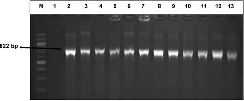 Figure 6 An illustrative gel electrophoresis image for the detection of sulI (822 bp) resistance gene from the sulfonamide-resistant DEC. Lane (M) molecular weight marker (100 bp DNA ladder, Thermo scientific), lane 1: negative control, lane 2 to 13: some of the representatives of the genetic expression of sulI (822 bp) from the sulfonamide-resistant DEC.