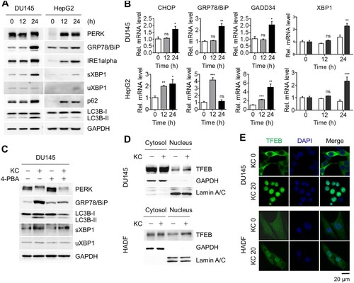 Figure 3. Induction of both autophagy and UPR in cancer cell lines. (A) DU145 and HepG2 cells were treated with KC (20 µM for 0, 12, or 24 h) and ER stress-associated UPR signaling proteins were detected. (B) mRNA levels of CHOP, GRP78/BiP, GADD34, sXBP1, and uXBP1 were measured by qRT-PCR. (C) DU145 cells were treated with either KC (20 µM), 4-PBA (5 mM) alone for 16 h, or pre-treated with 4-PBA 4 h before the treatment with KC, and diminished levels of ER stress marker proteins were analyzed by immunoblotting. (D) DU145 cells stably overexpressed by TFEB were treated with KC (20 µM) for 24 h. HADF cells were treated with KC and TFEB translocation (endo) from cytosol to nucleus was determined through subcellular fractionation followed by immunoblotting. (E) The cells were treated with KC and immunostained with anti-TFEB and anti-rabbit (H + L) secondary antibody conjugated with FITC (Green). Cell nuclei were stained with DAPI (Blue). Scale bar = 20 µm.