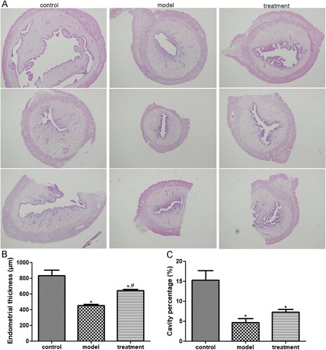Figure 1. The protective effects of acupuncture on the uterus of ovulation induction rats. (a) The uterus morphology in the rats of the control, model, and treatment groups under a magnification of 40×. (b) The endometrial thickness of the rats with different treatments. (c) The uterine cavity percentage of the rats with different treatments. *: P < .05, compared with the control group; #: P < .05, compared with the model group.