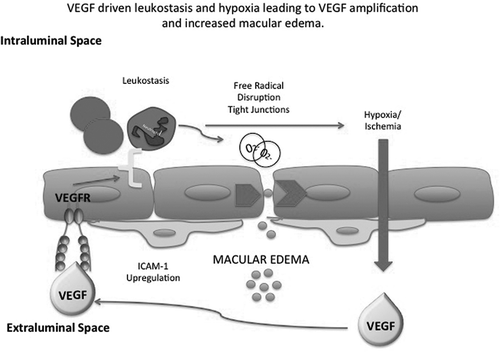 Figure 2b. VEGF causes chemoattraction of leukocytes and up-regulation of ICAM-1. This causes capillary non-perfusion and ischemia and amplification of VEGF production resulting in an increase in macular edema.