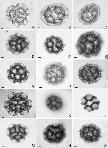 Figure 1. Pollen types of Lessingianthus (LM). A– C. Pollen type “B”, L. argyrophyllus: A. Polar view; B. Equatorial view, mesocolpium; C. Equatorial view showing aperture. D– F. Pollen type “B-1”, L. soderstroemii: D. Polar view; E. Equatorial view, mesocolpium; F. Equatorial view, aperture, high focus. G– I. Pollen type “B-2”, L. santosii: G. Polar view; H. Equatorial view; I. Equatorial view with aperture, high focus. J– L. Pollen type “B-3”, L. chamaepeuces: J. Polar view; K. Equatorial view; L. Equatorial view, aperture. M– O. Pollen type “D”, L. cristalinae: M. Polar view; N. Equatorial view; O. Equatorial view, aperture. Scale bars – 10 μm.