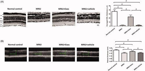 Figure 2. (A) RD was induced by an intraperitoneal injection of MNU. The subretinal injection of RPE-Exos was performed instantly after MNU administration. Morphological analysis was performed 2 weeks following treatment. Retinal architecture of MNU administered mice was effective preserved by RPE-Exos treatment. The mean ONL thickness of RPE-Exos treated group was significantly larger compared with MNU group. (B) OCT examination of the RPE-Exos treated group also revealed significant protective effects, seen as a thicker total retina thickness compared with MNU group (ANOVA analysis followed by Bonferroni’s post hoc analysis was performed, #p < .01, for differences between groups; n = 8; GCL: ganglion cell layer; IPL: inner plexiform layer; OPL: outer plexiform layer; ONL: outer nuclear layer; INL: inner nuclear layer; OS: outer segments).